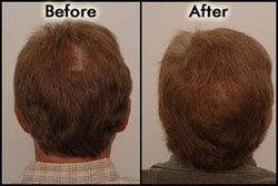 Before/After