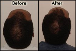 Before/After