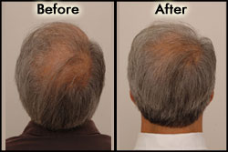Before/After